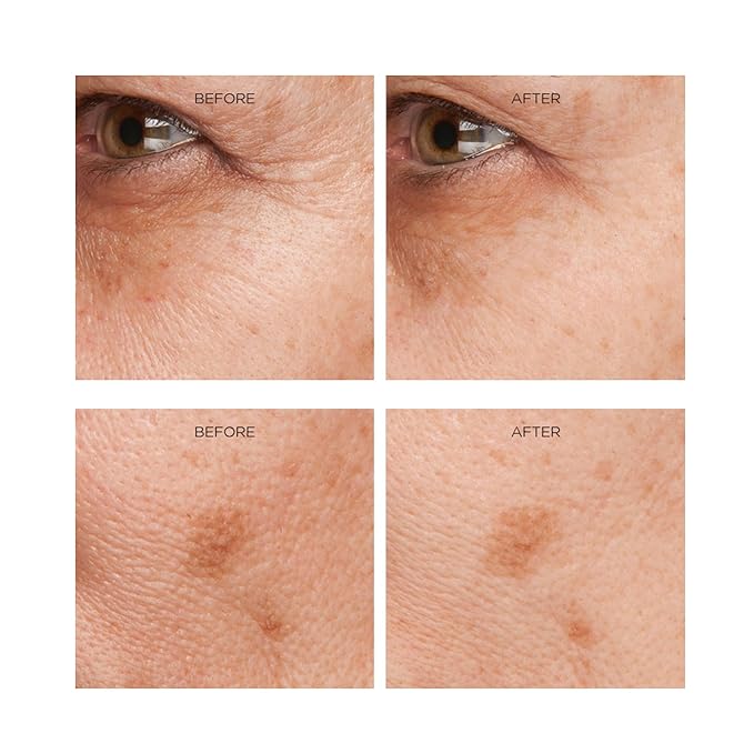 Rejuvenation Serum for Line Lifting and Crow's Feet-Velvo Beauty