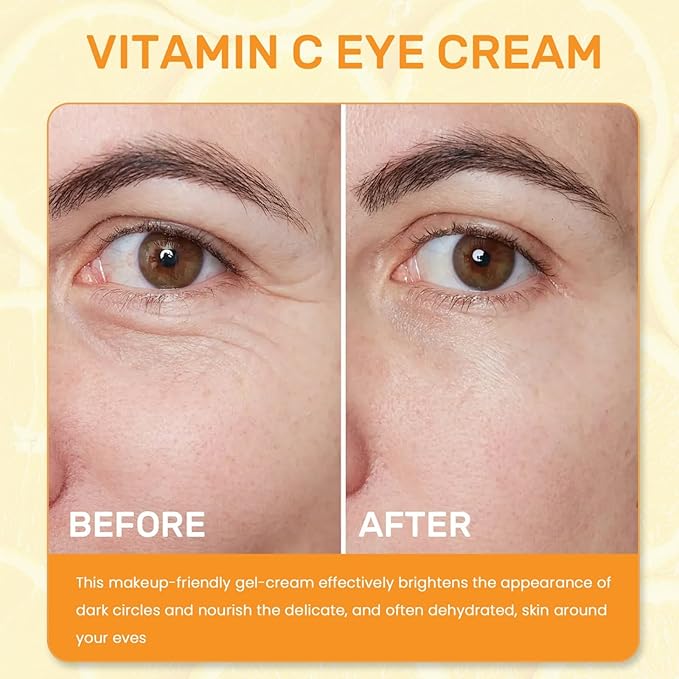 Vitamin C Eye Cream For Dark Circles, Under Eye Cream Anti Wrinkles For Reduce Puffiness And Bags Fine Lines, Wrinkles, Hydrating Eye Lifting Skin Care Anti Aging Eye Cream(0.7 FL.Oz)-Velvo Beauty