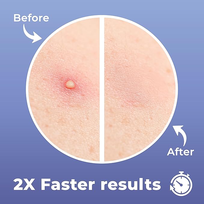 Salicylic Pimple Patches (120 Pack), Salicylic Acid Acne Patches with Tea Tree Oil - Zit Patch and Pimple Stickers for Face for Skin Care - Salicylic Acid Acne Dots (Packaging May Vary)-Velvo Beauty