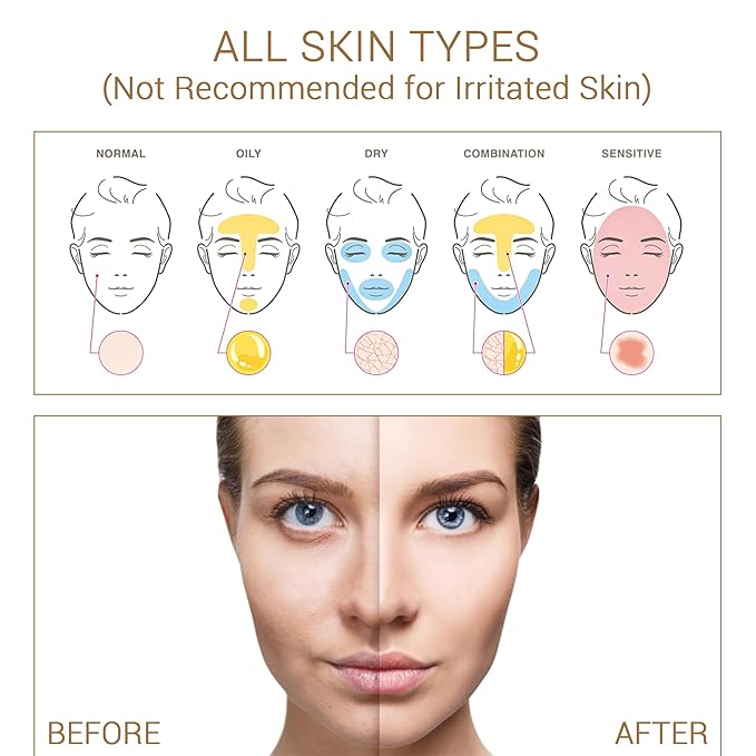 Niacinamide with Salicylic Acid Serum for Face, Hydrating Dark Spot Facial Serum & Plumb Skin, Daily Skincare Essential, 1 fl. oz, Made in Europe-Velvo Beauty