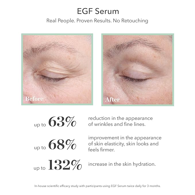 BIOEFFECT EGF Serum Treatment Duo with Hyaluronic Acid, Enhance Skin with Moisturizing, Firming, Wrinkle-Fighting Treatment for Face And Neck, Day And Night, Best Derma Roller Facial Serum-Velvo Beauty