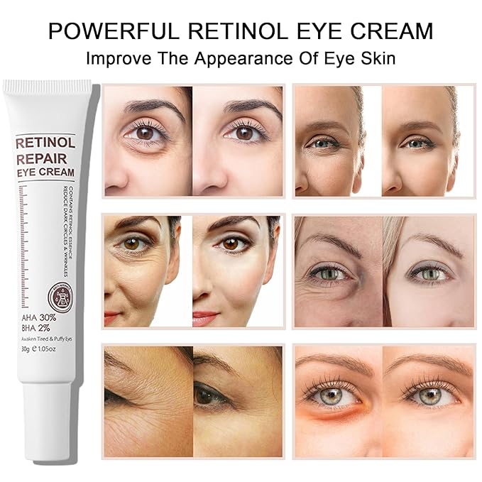 Retinol Eye Cream Anti Aging + 24k Under Eye Patches Kit, Under Eye Patches For Puffy Eyes And Dark Circles, Under Eye Cream With Retinol Serum,Dark Circle Eye Cream For Moisturizing, Firming-Velvo Beauty