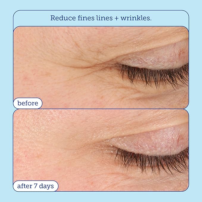 Skinfix Barrier+ Triple Lipid-Boost 360° Eye Cream: Targets Dark Circles, Puffiness, and Fine Lines Around Eyes and Lids, Clinically Proven to Brighten and Refresh Eyes, 0.5 oz-Velvo Beauty