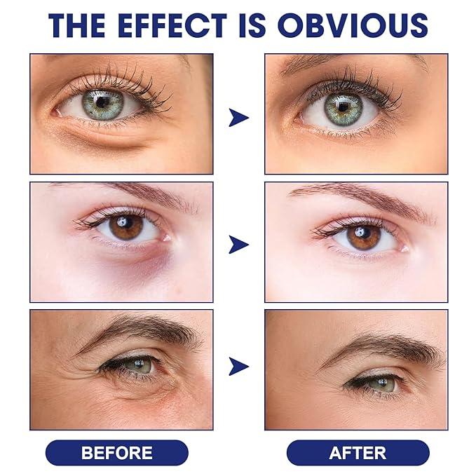 Anti Wrinkle Essence, Glozie Eye Serum, Glozie Instant Eye Lift Eye Cream, Anti Wrinkle Serum, Eye Cream For Wrinkles, Instant Anti-Aging Firm Eye Temporary Eye Tightener, Permanent Anti-Aging Cream-Velvo Beauty