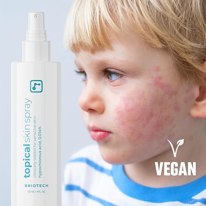 BRIOTECH Topical Skin Spray, Hypochlorous Acid Spray for Sensitive Skin, HOCl Facial Mist, Full Body Support Against Irritation, Calm Redness, Soothe Foot & Scalp, 2 oz Travel Size-Velvo Beauty