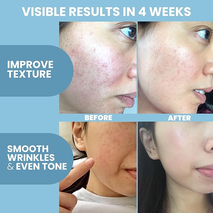 Collagen Peptide Serum for Face – Anti Aging Facial Treatment with Peptides & Hyaluronic Acid – Gentle Formula for Sensitive Skin, Microneedling Pen, Derma Roller, Skin Firming & Hydrating (2 Oz)-Velvo Beauty