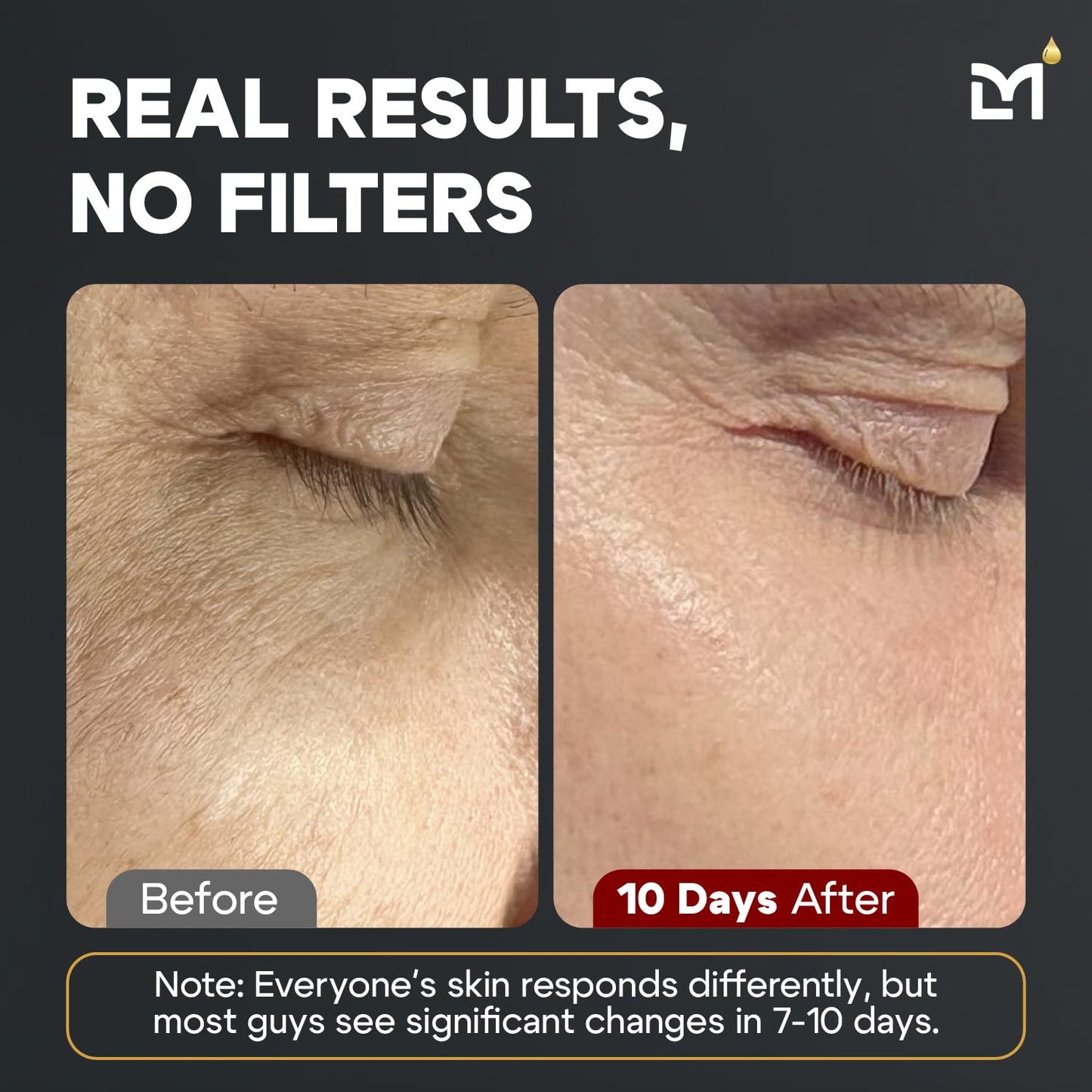 Titan Sports Anti-Aging Mens Skin Care Kit – Cleanser, Face Serum, Eye Cream, Face Moisturizer – Men, Skin Care Set – Dark Circles, Wrinkles, Fine Lines – Vitamin C, Niacinamide, HA–Unscented-Velvo Beauty