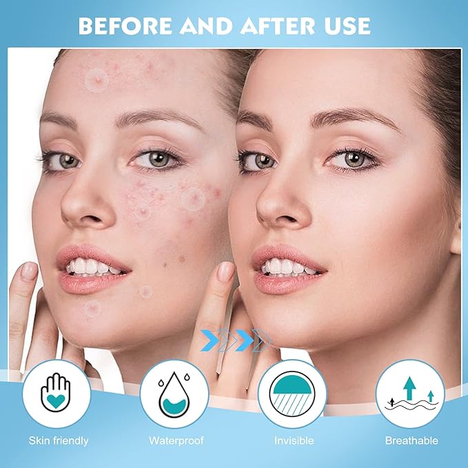 Pimple Patches for Face - 360 Counts Hydrocolloid Acne Patches Salicylic Acid with Tea Tree Oil for Zit Blemish Spot Covers Invisible Hydrocolloid Patches Pimple Acne Stickers-Velvo Beauty