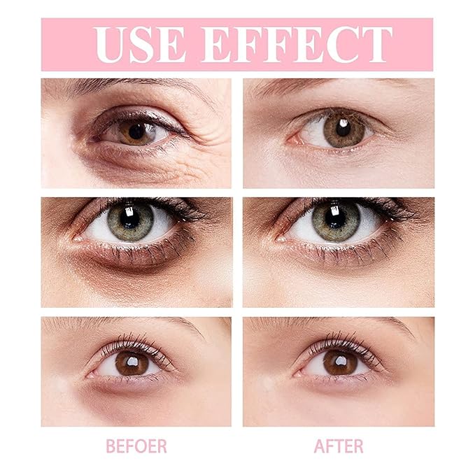 Retinol Polypeptide Eye Cream,Retinol Eye Cream for Dark Circles and Puffiness, Visible Results in 3-4 Weeks, Under Eye Cream for Anti Aging, for Puffiness and Bags to Reduce Fine Lines(2pcs)-Velvo Beauty
