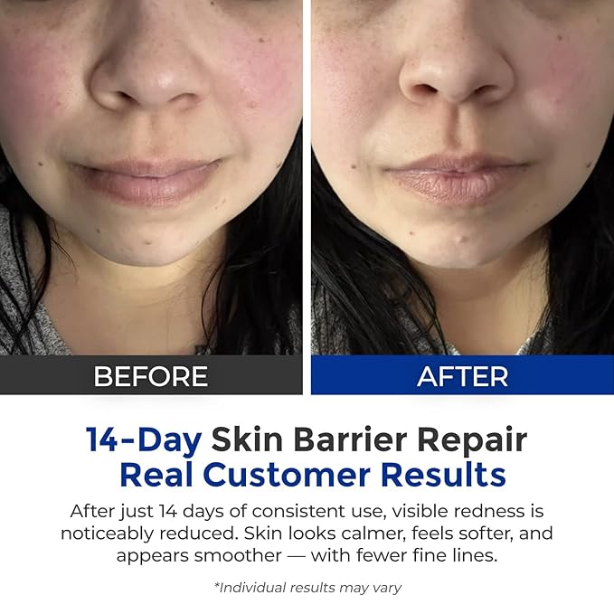 Intensive Repair Serum, 15%Hyaluronic Acid for Sensitive Skin Anti Aging Ultra Hydrating Serum for Face Calming Barrier Repair Redness Relief with Ceramides Centella 30Vials Daily Travel Care-Velvo Beauty