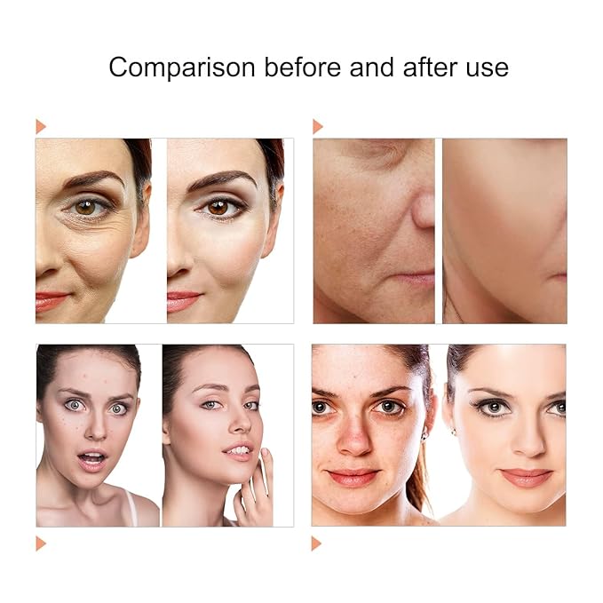 7 Color LED Face Mask LED Light Therapy Equipment for Skin Care at Home-Velvo Beauty