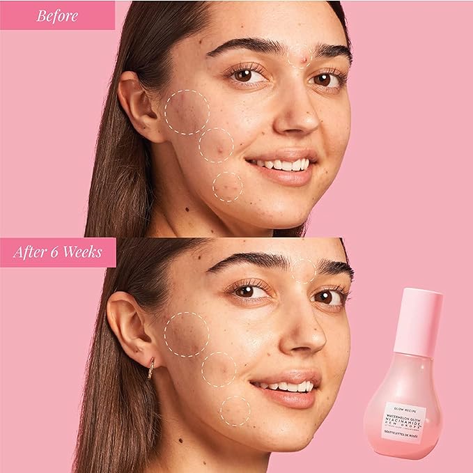 Glow Recipe Watermelon Niacinamide Dew Drops, Travel Size - Brightening, Plumping Hydrating Face Serum, Makeup Primer + Liquid Highlighter with Hyaluronic Acid - Dewy & Glowing Korean Skin Care (15ml)-Velvo Beauty