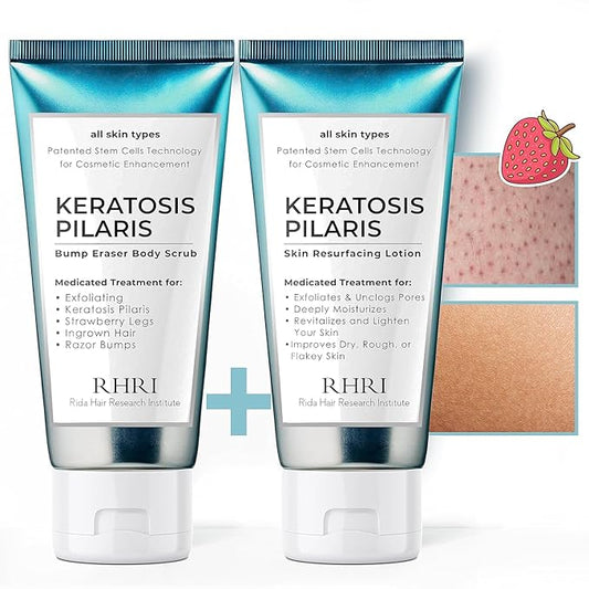 KP Bump Eraser Body Set | Keratosis Pilaris Treatment | Keratosis Pilaris Lotion | Exfoliating Body Scrub | Ingrown Hair Treatment | Bundle Set for Bump, Strawberry Legs, Redness, Dry & Flakey Skin-Velvo Beauty