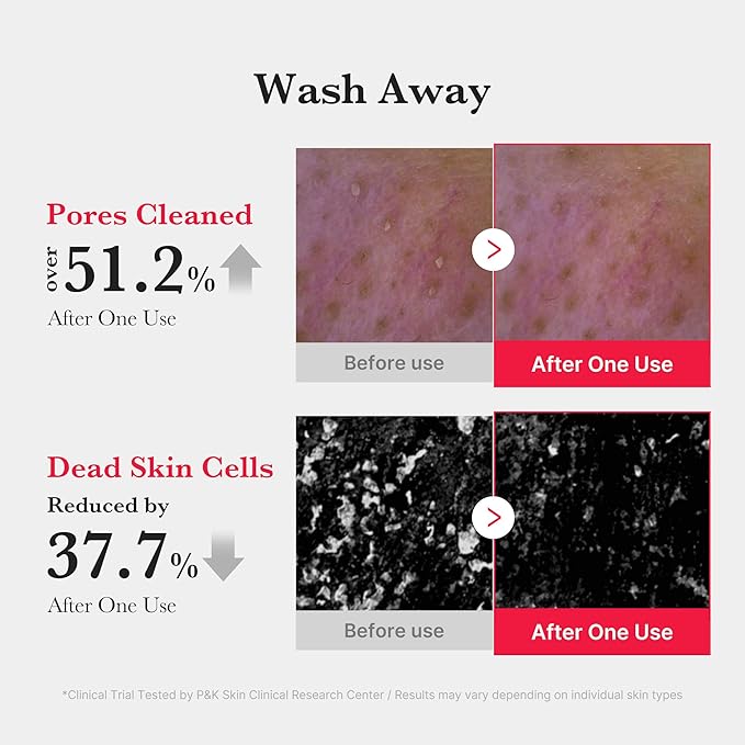 medicube Red Foam Cleanser - Deeply cleanses, remove impurities, control sebum, | Korean Skincare-Velvo Beauty