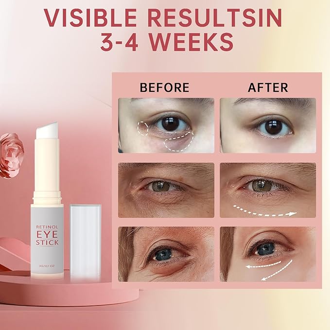 1Pcs Retinol Eye Stick, Retinol Under Eye Cream for Puffiness and Dark Circles, Hydrating Eye Cream Anti Aging for Enhanced Under Eye Nourishment.-Velvo Beauty