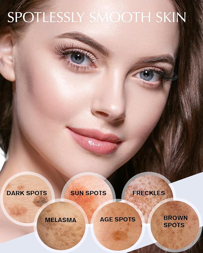 Dark Spot Remover for Face and Body: Hyperpigmentation Treatment - Natural Ingredient - Freckle/Melasma/Sun Spot/Age Spot Remover - Dark Spot Corrector Cream for Women and Men-Velvo Beauty