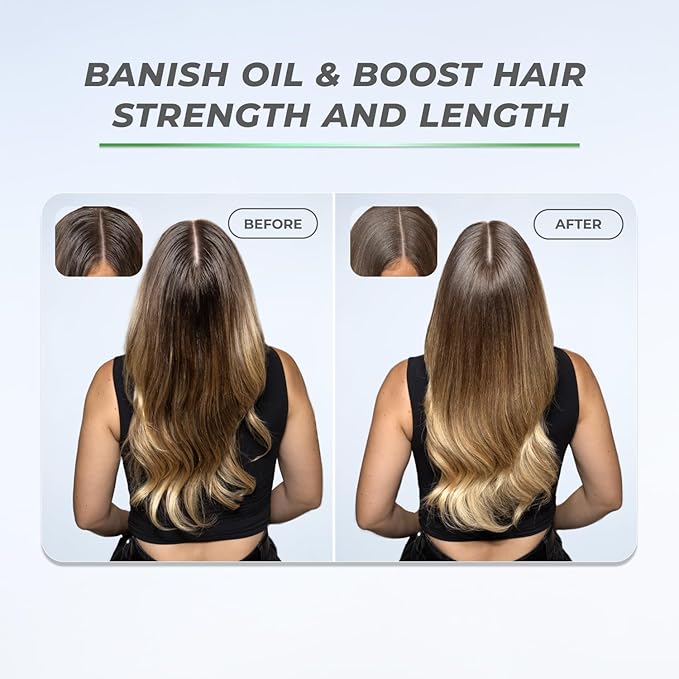 XMONDO Hair BOOST X Dry Shampoo, Zero Residue, Formulated with Saw Palmetto to Promote Scalp Care, Clinically Tested, Dermatologist Tested, Talc-free, Benzene-free, Free of aluminum starch, 5 oz-Velvo Beauty