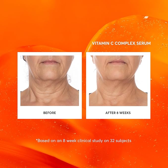 Naturium Vitamin C Complex Face Serum Jumbo, Anti-Aging Facial Treatment with Hyaluronic Acid & Vitamin E, 2 oz-Velvo Beauty
