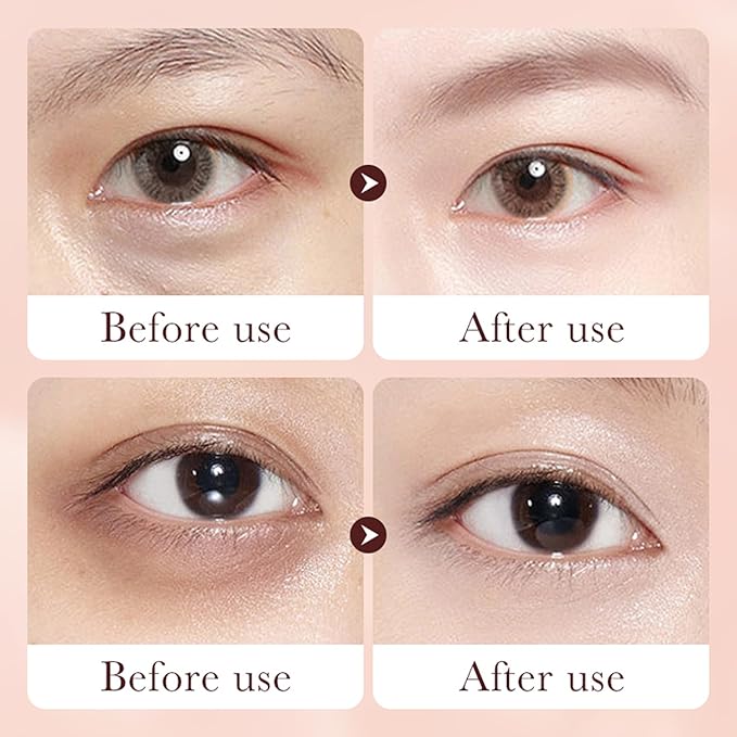 Retinol Eye Cream Stick for Dark Circles Under Eye Treatment, Puffiness and Bags - Firming & Hydrating Eye Cream for Anti-Aging Results in 3-4 Weeks-Velvo Beauty