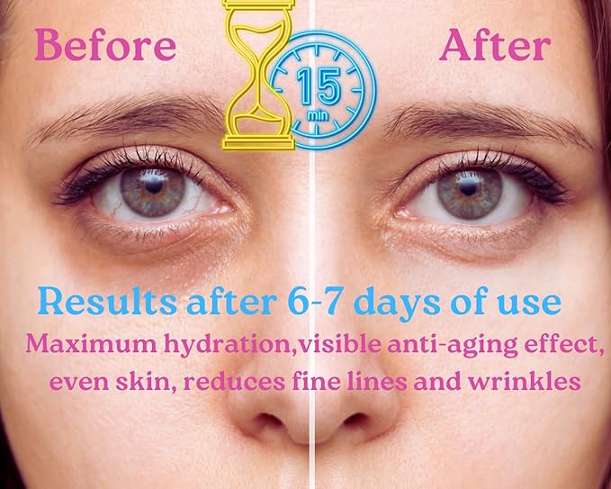 Under Eye Patches, Eye Masks, Under Eye Patches for Puffy Eyes and Dark Circles, Under Eye Mask, Under Eye Patches Dark Circles-Velvo Beauty