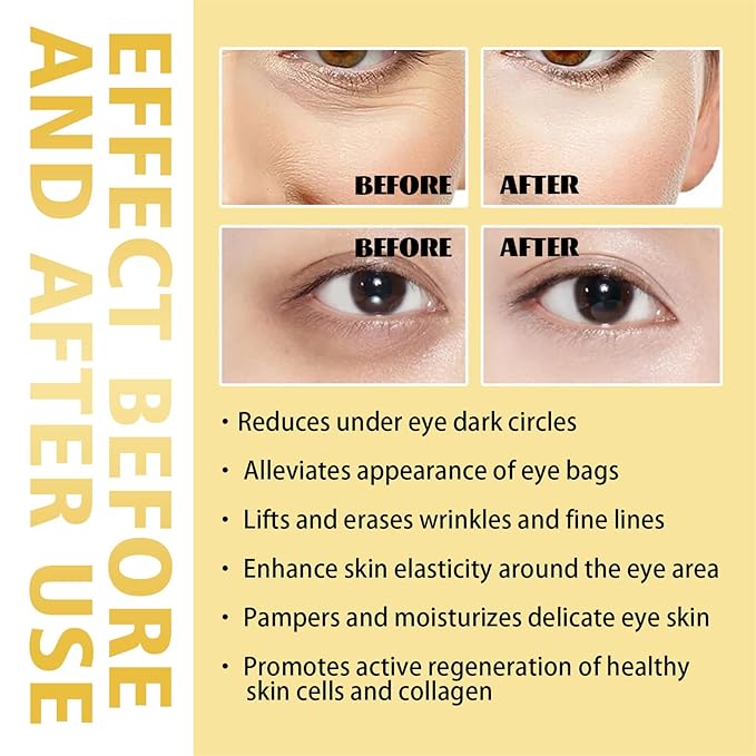 Time Eraser Rollerball Castor Oil and Frankincense, Time Eraser Rollerball, Castor Oil and Frankincense Eye Roller for Reducing Dark Circles and Bags Under Eyes-Velvo Beauty