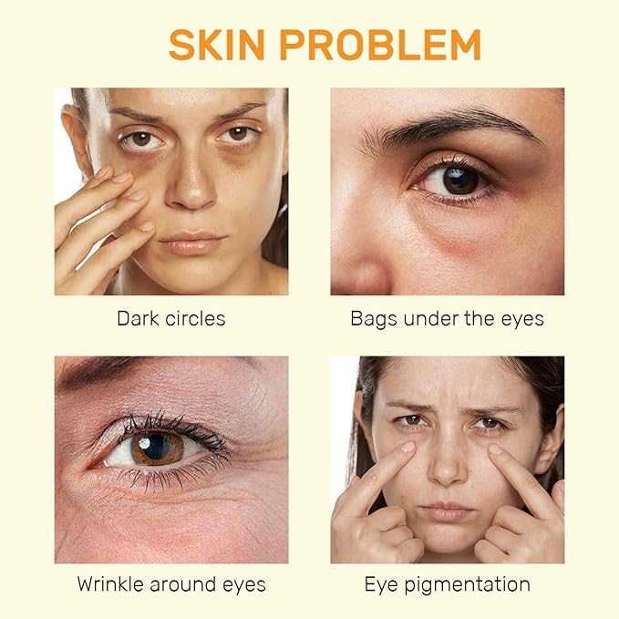 Vitamin C Eye Cream For Dark Circles, Under Eye Cream Anti Wrinkles For Reduce Puffiness And Bags Fine Lines, Wrinkles, Hydrating Eye Lifting Skin Care Anti Aging Eye Cream(0.7 FL.Oz)-Velvo Beauty
