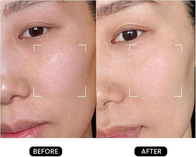 Revive Skincare for Anti-Aging, Glow Like Never Before,Multifunctional Beauty Device, Facial Massager for Home use-Velvo Beauty