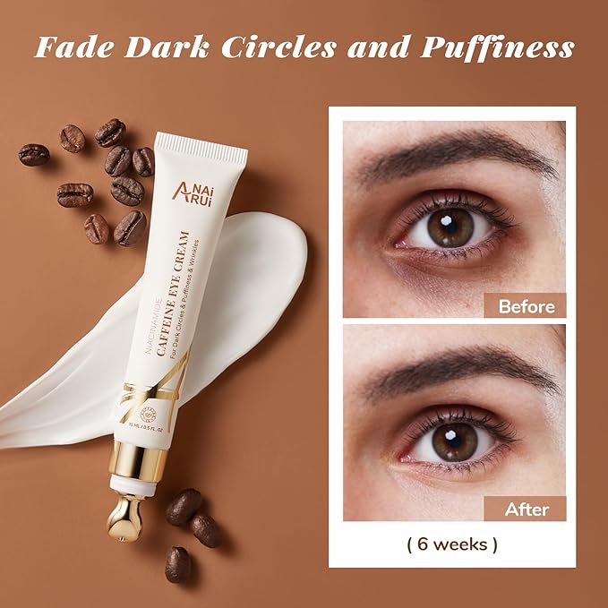 ANAI RUI Caffeine Eye Cream, Niacinamide Eye Cream for Dark Circles and Puffiness, Anti Aging & Friming Eye Cream with Eye Roller, Caffeine Under Eye Cream for Puffy Eyes, Bag Treatment 0.5 FL.OZ-Velvo Beauty