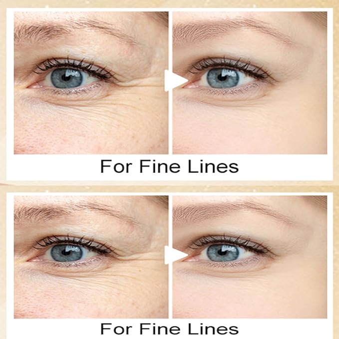 20g Eye Cream with Electric Massager, Moisturizing Anti-Wrinkles Eye Cream, Anti Aging Eye Cream for Dark Circles and Puffiness, Results in 3-4 Weeks to Reduce Fine Lines-Velvo Beauty