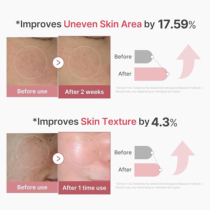 medicube PDRN Pink Collagen Exosome Shot Serum 2,000 PPM | Liquid Skin Booster | Exosome, Salmon DNA PDRN, Spicules | Uneven Skin Tone, Pore Care, Skin Texture | Korean Skin Care 1.01 fl.oz-Velvo Beauty