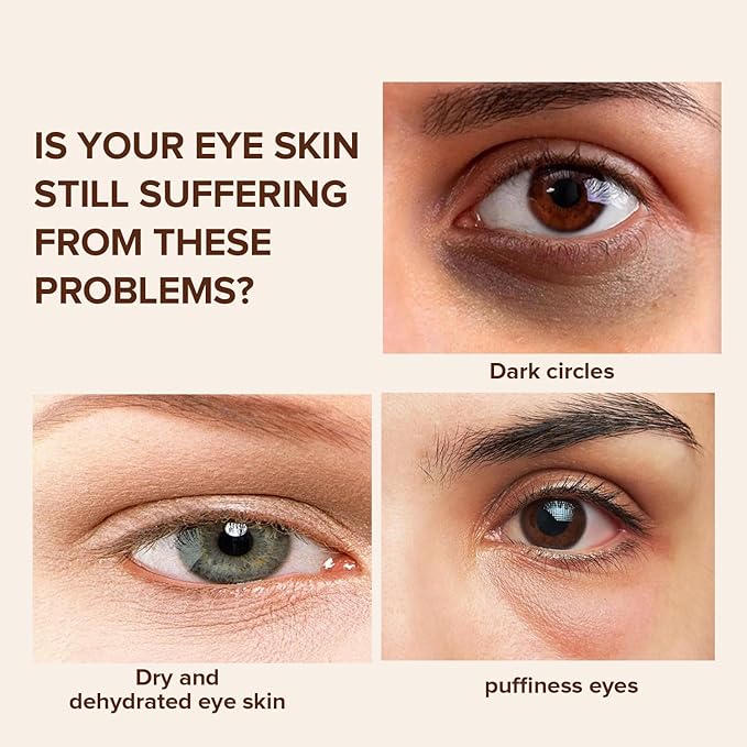 Caffeine Eye Cream for Dark Circles, Under Eye Treatment Eye Cream with Caffeine Anti Aging Wrinkles Lifting Firming Moisturizer Tightening Eye Cream 20ML-Velvo Beauty