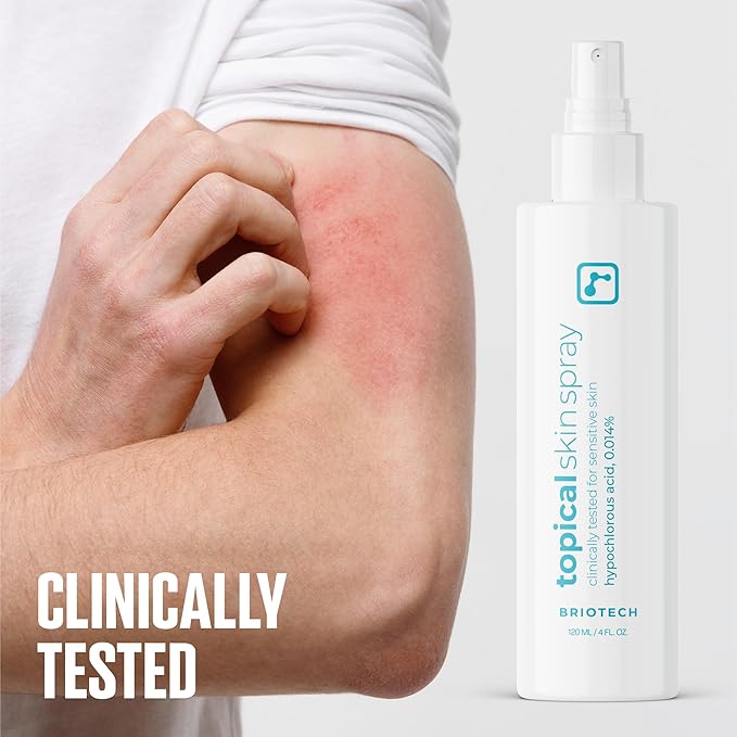 BRIOTECH Topical Skin Spray, Hypochlorous Acid Spray for Sensitive Skin, HOCl Facial Mist, Full Body Support Against Irritation, Calm Redness, Soothe Foot & Scalp, 2 oz Travel Size-Velvo Beauty