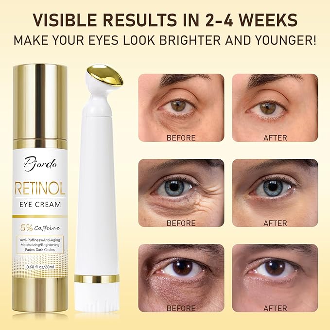 Retinol Eye Cream for Dark Circles Puffiness, Under Eye Cream Anti Aging Eye Cream Reduce Wrinkles & Fine Lines, 5% Caffeine Eye Cream with Eye Massage Wand, Perfect Gifts-Velvo Beauty
