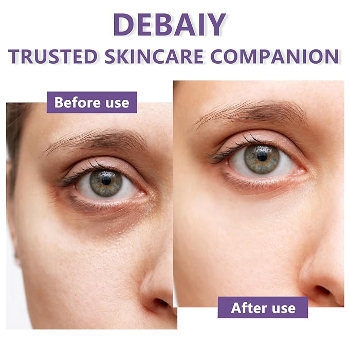 3 Pack Eye Cream Hydrating & Repairing with Hyaluronic Acid & Peptides - Moisturizes, Smooths Fine Lines, Enhances Elasticity (Each 0.529oz | 15g)-Velvo Beauty