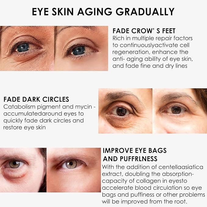 Eye Cream, STCORPS7 Vibrant Glamour Silk Protein Anti-Wrinkle And Firming Eye Cream For Wrinkles, Fine Lines, Dark Circles, Puffiness & Bags, 20g-Velvo Beauty