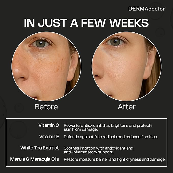 DERMAdoctor Night Face Oil Toner Anti-Aging Hydrating - 20% Vitamin C Ester, Vitamin E, Ferulic Acid, & Marula Oil for Face | Concentrated Vitamin-C Ester Facial Oils | Dermatologist Formulated - 1 Oz-Velvo Beauty
