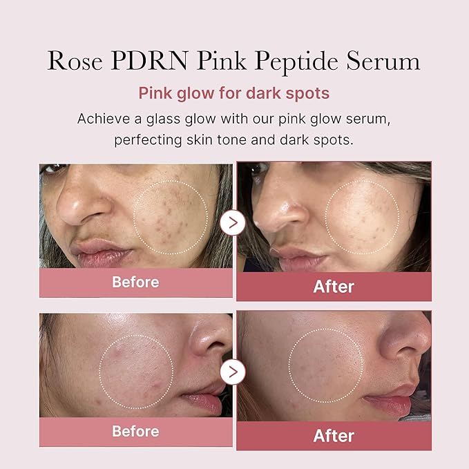 medicube PDRN Pink Peptide Serum, Pink glow serum, Peptide, Niacinamide, Hydrating & Moisturizing & Firming, Uneven Skin Tone, Korean Skincare | 1.01 fl.oz. (1.01 fl.oz., Rose PDRN (Vegan))-Velvo Beauty