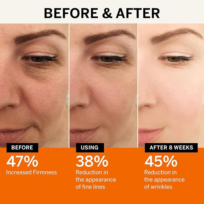 Vitamin C Face Serum: Anti Aging Super Vit C Facial Serum with Ferulic Acid Pure L-Ascorbic Acid, Vitamin E and Hyaluronic Acid for Dark Spots and Skin Care-Velvo Beauty