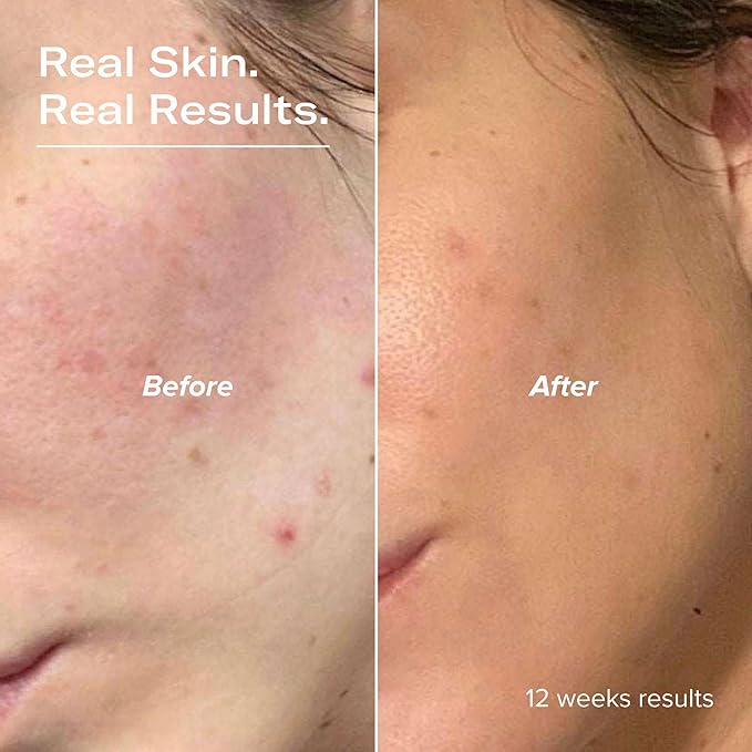 PLUMP Hyaluronic Acid Serum with 5D Hyaluronic Complex, Ectoin, Plant Ceramides, Vitamins B5 & E, Deep Hydration, Strengthens Skin Barrier, Fragrance-Free, 1 fl oz-Velvo Beauty
