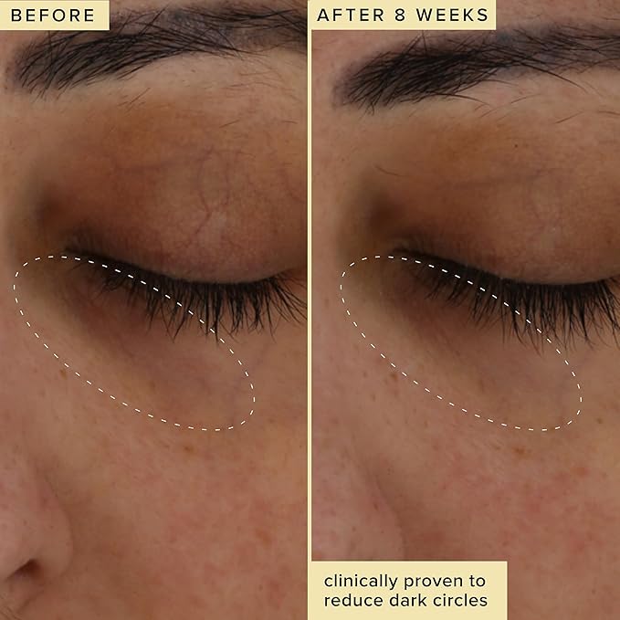 Farmacy Brightening Eye Cream - Wake Up Honey Under Eye Cream for Dark Circles + Puffiness - Caffeine Eye Cream Enriched with Vitamin C + Cranberry Peptide to Smooth Wrinkles Over Time (15ml)-Velvo Beauty