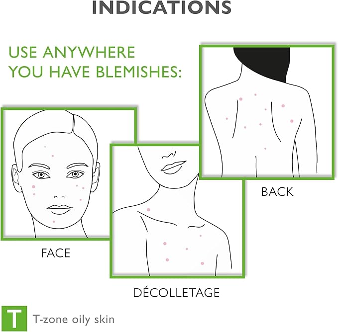 Face & Body Breakout Solution - 3% Mandelic Acid Helps Clarify Blemish & Acne Prone Skin, Face, Back & Chest Pimples Exfoliating & Clearing Treatment, SEBO-ALMOND-CLARIS, 6.42 fl oz-Velvo Beauty