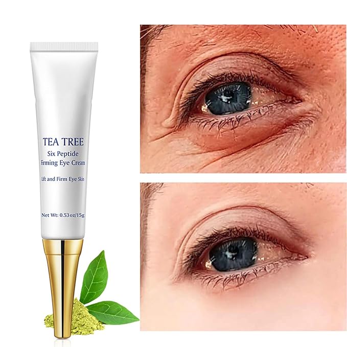 Eye Cream for Dark Circles Under Eye Cream for Puffiness and Bags Tea Tree Six Peptide Fiming Anti-Aging Eye Cream for Wrinkles Improve Fine Line Eye Repair Care,15g/0.53oz-Velvo Beauty