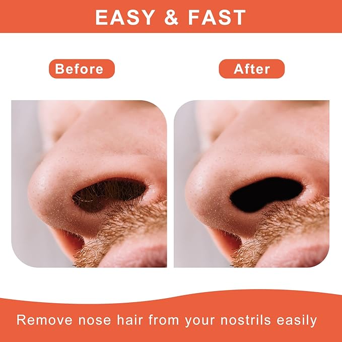 Nose & Ear Hair Wax Kit for Men & Women, 100g Wax with 20 Applicators, Safe Home Grooming Solution for Painless 15-20 Time Usage-Velvo Beauty