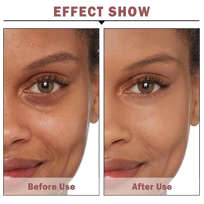 NVLEPTAP Eye Cream for Dark Circles and Puffiness Under Eye Cream for Wrinkles and Bags Reduce Wrinkles and Fine Lines Lift Firm Skin Around the Eyes-Velvo Beauty