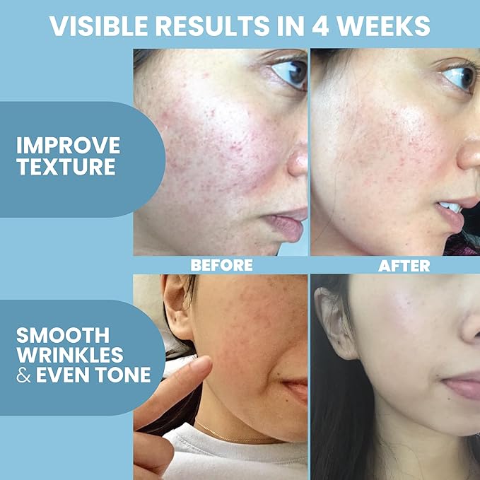Collagen Peptide Serum for Face – Anti Aging Facial Treatment with Peptides & Hyaluronic Acid – Gentle Formula for Sensitive Skin, Microneedling Pen, Derma Roller, Skin Firming & Hydrating (1 Oz)-Velvo Beauty