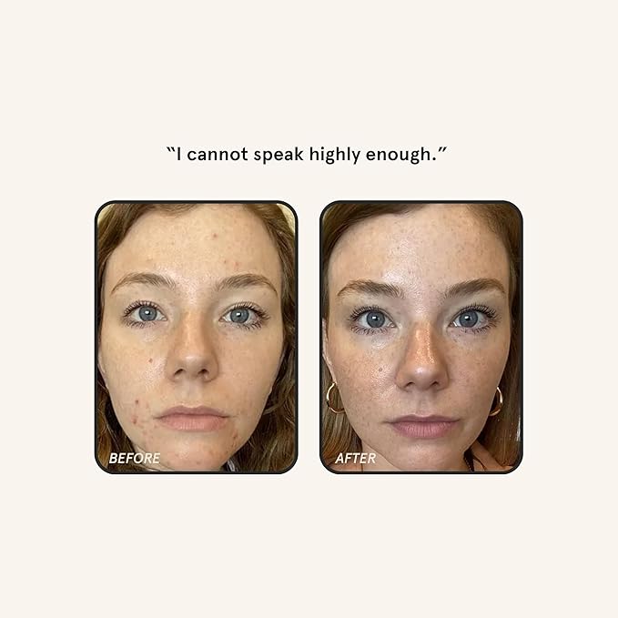 Barefaced Retinal Skin Therapy 30ml - Retinaldehyde & Bakuchiol Serum for Firming, Reducing Fine Lines & Wrinkles, Improving Skin Tone & Texture w/ Shea Butter, Jojoba Oil & Argan Oil-Velvo Beauty