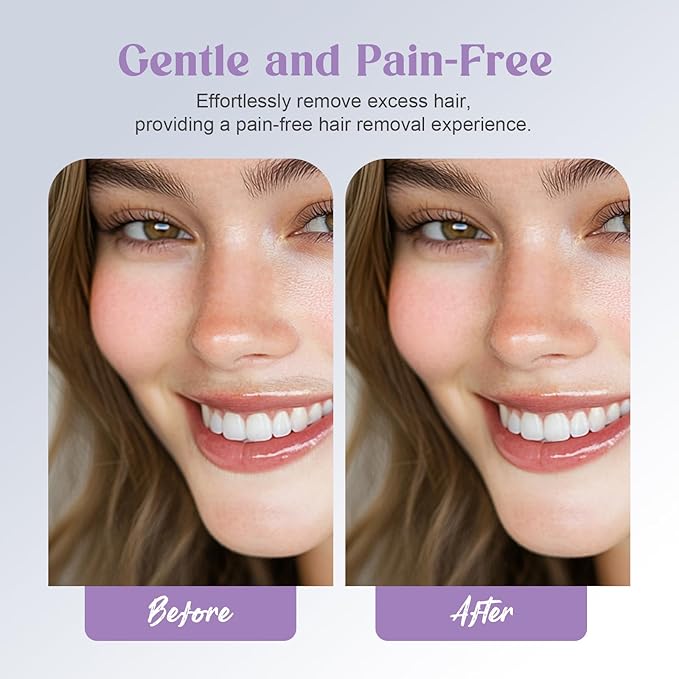 Battery Powered Facial Hair Remover for Women Lips, Chin, Neck, and Cheeks - Gentle and Pain with 2-pc Replacement Heads (Battery is not Included)-Velvo Beauty