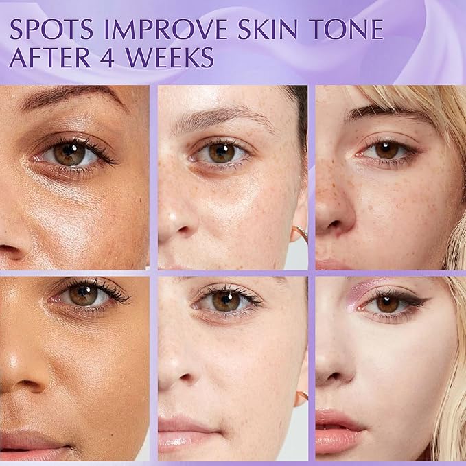 Dark Spot Remover for Face Cream, Dark Spot Corrector, Rapid Tone Repair Retinol Serum for Sun Spots, Age Spots, Skin Brown, Melasma Skin Care with Upgraded Formula Vitamin C for Women 1.7 Fl OZ-Velvo Beauty