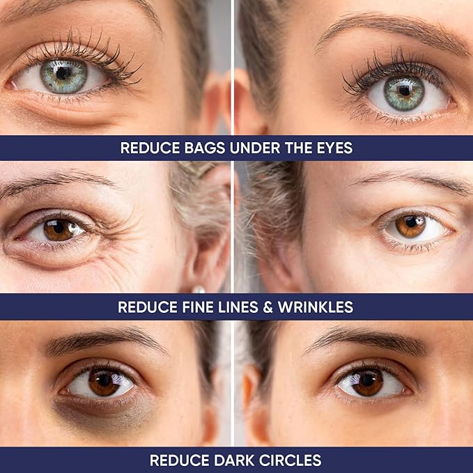 Instant Ageless Eye Cream – Anti Wrinkle Cream, Removes Under Eye Puffiness, Bags, Expression Lines, & Dark Circles. Powerfully Tighen & Lifts Sagging Skin. Disappears Before Your Eyes In Minutes.-Velvo Beauty