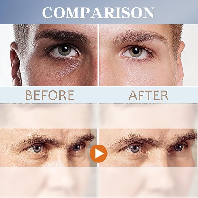 Men's Restoring Eye Cream Under Eye Cream for Dark Circles & Puffiness, Delay Aging Process of Eye Skin, Hydrating & Moisturizing, Reduces Puffiness, and Fine Lines-Velvo Beauty